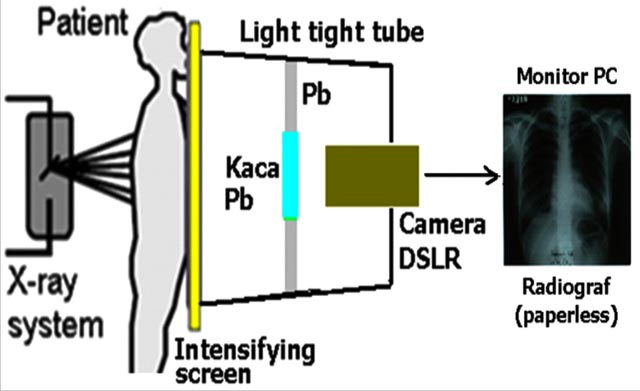 Radiografi Digital Mobile untuk Lab Fisika Medik